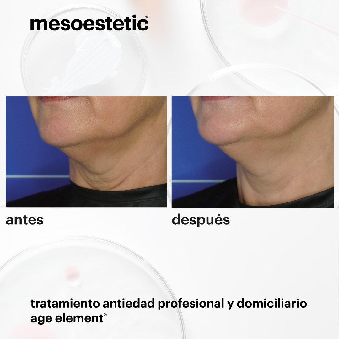 La Clínica Tecma estrena en agosto una nueva gama antiedad de estética para prevenir el envejecimiento